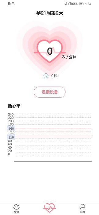 fetalheart胎心仪app v1.1.832 安卓版 1