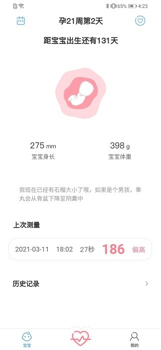 fetalheart胎心仪app v1.1.832 安卓版 3
