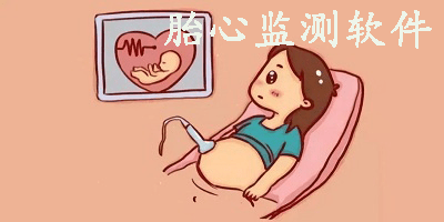 胎心监测位置图片